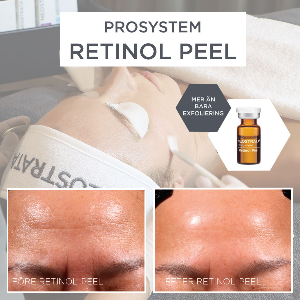 retinolbehandling